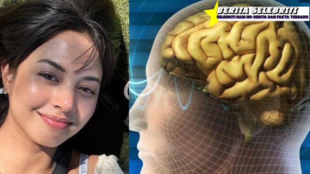 Aurelie Moeremans Belum Pulih Total, Begini Kata Dokter!